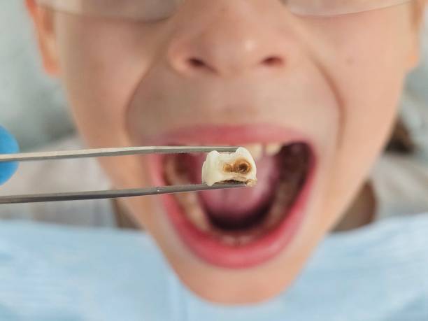 Best Emergency Cosmetic Dentistry in West Liberty, OH
