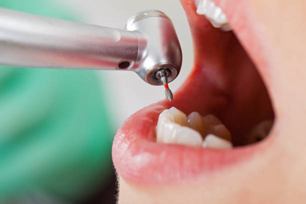 Best Urgent Dental Care for Toothache in West Liberty, OH
